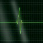 Serviços Bonavita 4 eletrocardiograma